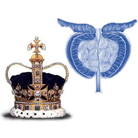L’intervento alla prostata di Re Carlo III