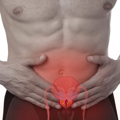 La prostata Infiammata: come si diagnostica e come si cura