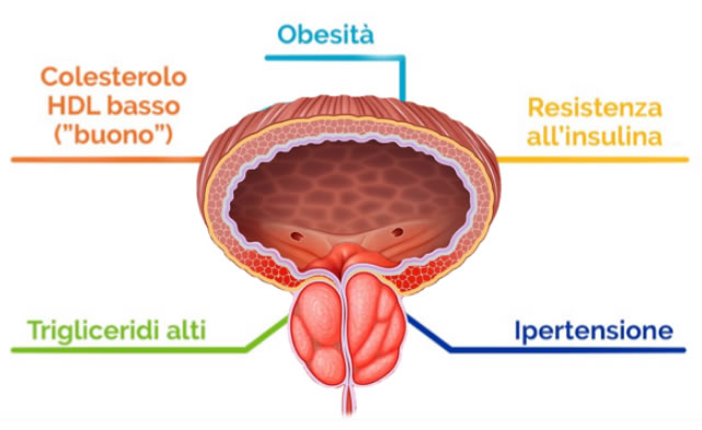 sindrome metabolica