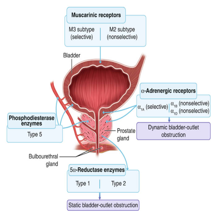 Terapie di combinazione per i sintomi urinari da Ipertrofia Prostatica Benigna